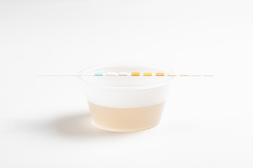 A combination of urine sample in a small round plastic container with a urine reagent strip deliberately and artistically set on a plain white background.