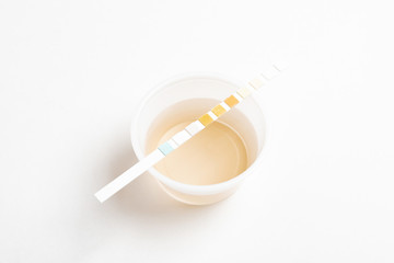 A combination of urine sample in a small round plastic container with a urine reagent strip deliberately and artistically set on a plain white background.