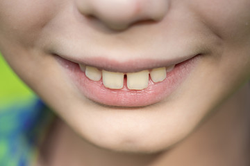 Closeup view of smiling mouth of cute funny white kid. Horizontal color photography.