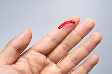 Bleeding blood from the cut finger wound. Injured finger with bleeding open cut wound. Closeup of finger human hand is cut hurt bleeding with bright red blood. 