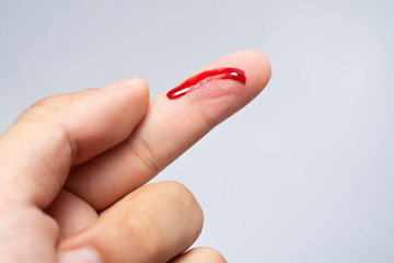Bleeding blood from the cut finger wound. Injured finger with bleeding open cut wound. Closeup of...