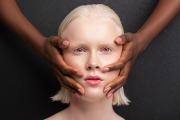 Grey-eyed woman having dark-skinned hands on face