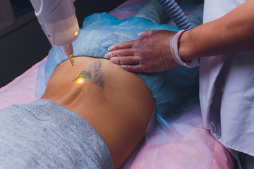 Cosmetologist with patient and professional tattoo removal laser in salon.