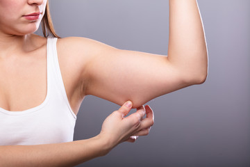 Woman Holding Arm With Excess Fat