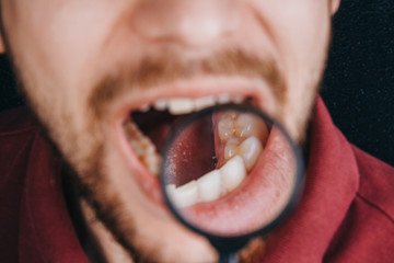 teeth under a magnifying glass. Portrait of a guy with a mustache close-up. beard on the face....
