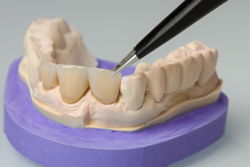 Fototapeta na wymiar detail work at artificial dentition in a dental laboratory