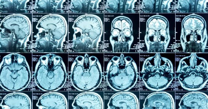 MRI scans in six rows, looped