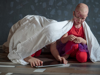 Fototapeta premium Caucasian children in pink t-shirt with smartphone on floor. Boys posing for camera under white blanket. One of children blond in glasses has chicken pox. Mom smeared follicles with pink solution