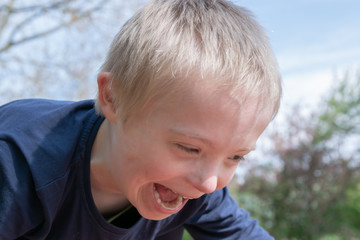   Defect,childcare,medicine and people concept: Blond boy with down syndrome playing in a park at spring time.
