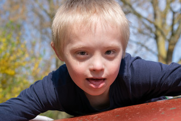   Defect,childcare,medicine and people concept: Blond boy with down syndrome playing in a park at spring time.