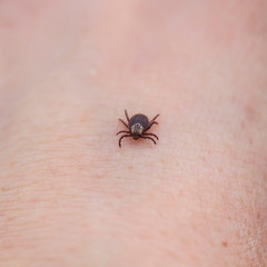 dangerous contagious insect a tick crawling on human skin