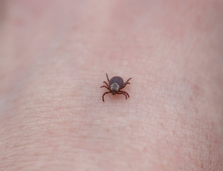 dangerous little contagious insect intensity a tick crawling on human skin