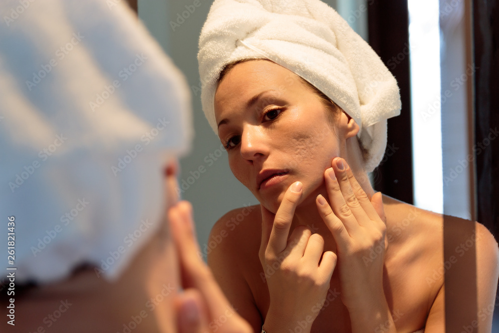 Wall mural young woman looking her acne scars on the mirror