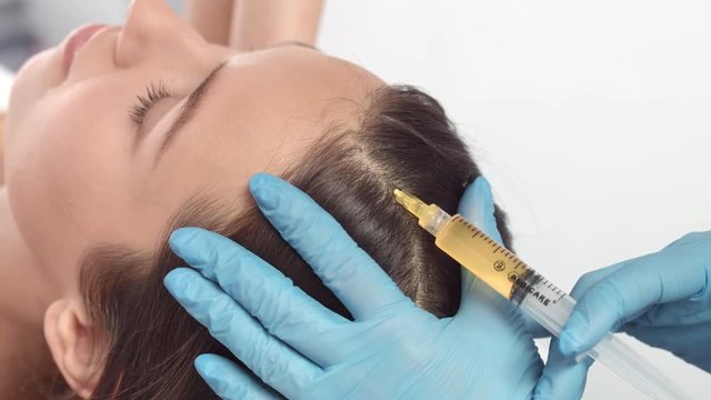Plasma injections for hair | Female patient