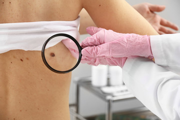 Dermatologist examining moles of patient in clinic, closeup