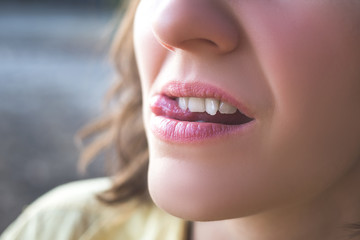 Photo of crooked woman teeth