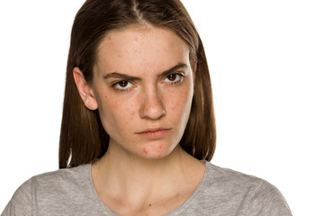 Young serious freckled woman without makeup on white background