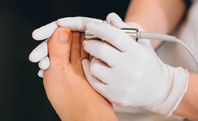 Patient receiving laser treatment on toenail, close-up. Fungal infection on the toenails....