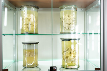 human brain in jar on light background in formalin . Medical clinic concept. science museum