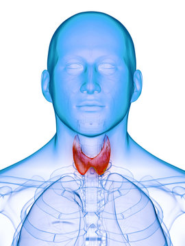 3d rendered medically accurate illustration of a diseased thyroid gland