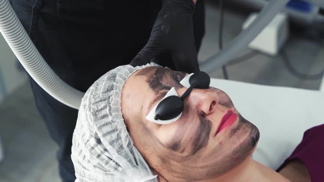 Close-up hands beautician makes carbon peeling procedure on face of young woman in clinic