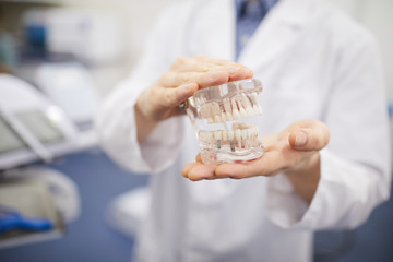 Close up of unrecognizable  dentist holding teeth model for prosthetists, copy space