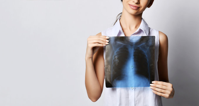 Doctor woman hold lungs X-ray examination of patient chest on gray 