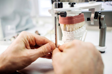 Prototypes of false teeth, creation of teeth, devices of prosthetics
