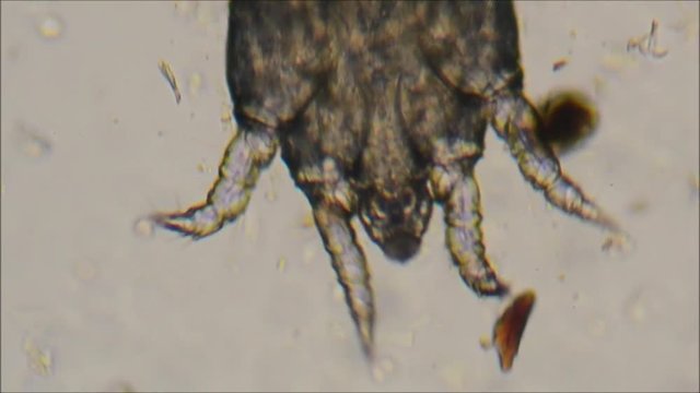 cat ear mite to microscope