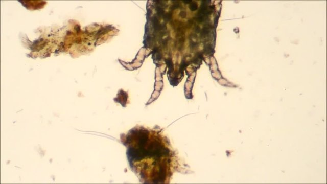 cat ear mite to microscope, pregnant female with eggs inside