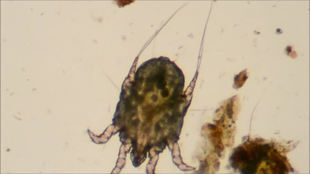 cat ear mite to microscope, pregnant female with eggs inside