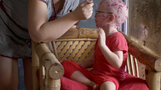Funny blond child with glasses has chicken pox. Mom smears follicles with pink solution of takkelani all over her body. Baby is sitting on  chair waiting for end of procedure. Chickenpox.