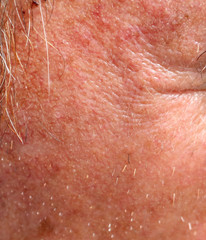 Fototapeta premium The skin of an old man as a background