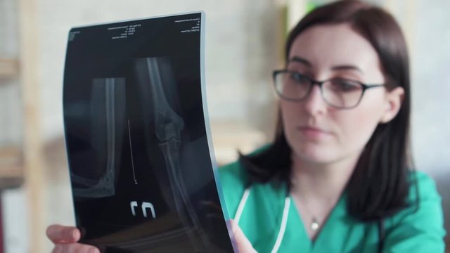 Doctor woman looks at the x-ray picture slow mo