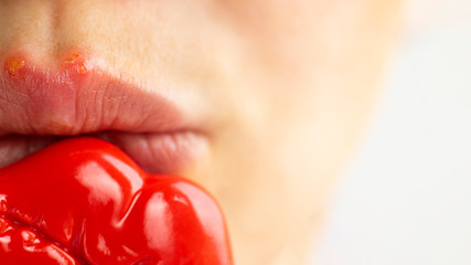 Part of a young woman face with red bubbles of virus herpes on lips that she tries to hide with toy...