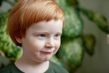 Boy with allergies on his face