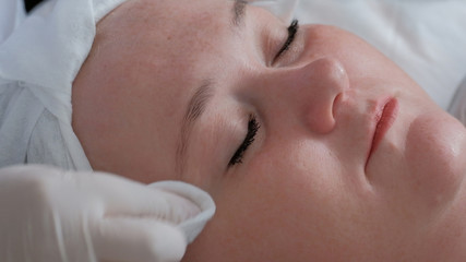 Close-up of the face of a full woman in a health and beauty salon. The hands of a professional cosmetologist in white medical wipe the skin of a fat girl s face with a cotton pad.