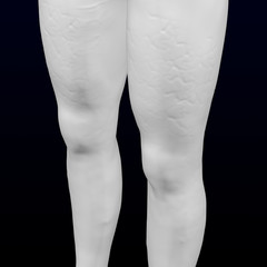 3d woman's legs with cellulite. 3D rendering.