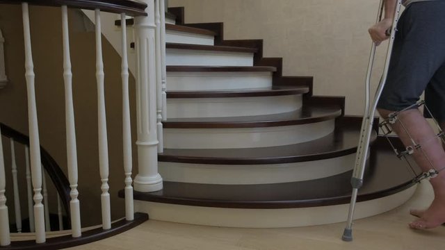 Descend the stairs on crutches with a broken leg in Ilizarov's external fixative