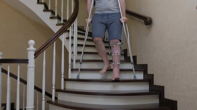 Descend the stairs on crutches with a broken leg in Ilizarov's external fixative