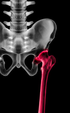 X-ray of lower half length human skeleton anterior view red highlight in femur or thigh bone pain area- 3D medical and Biomedical illustration- Human anatomy concept- Isolated on black background