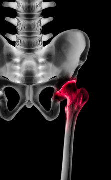 X-ray of lower half length human skeleton anterior view red highlight in hip socket pain area- 3D medical and Biomedical illustration- Human anatomy concept- Isolated on black background