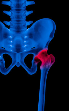 X-ray of lower half length human skeleton anterior view red highlight in the hip socket pain area- 3D medical and Biomedical illustration- Human anatomy concept- Blue tone color