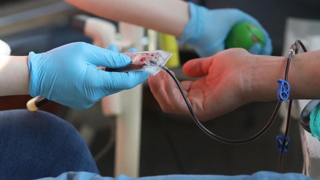 Blood Donation, Nurse receiving blood from blood donor in hospital. Blood tests to check your health before work, Nurse Working with Blood Donor at Hospital, Blood Plasma Fractionation, Squeezing Stre