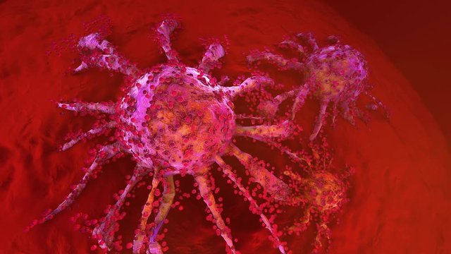 3D Animation of a growing Cancer cell spreading on healthy Tissue.