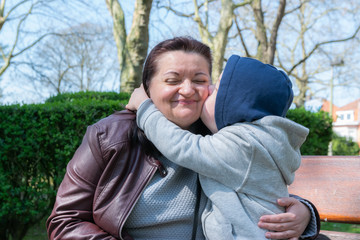  Defect,childcare,medicine and people concept: Happy mother and son with down syndrome playing together in a park.