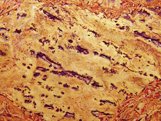 The texture of the natural material. Cork surface.