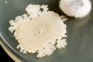 A detailed view of microorganisms cultivated inside a petri dish isolated against a black...