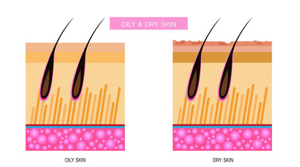 Oily & dry skin,Vector Illustration
