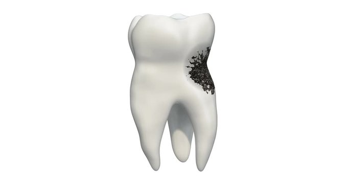 Tooth with caries, 3d animation. 3D rendering isolated on white background